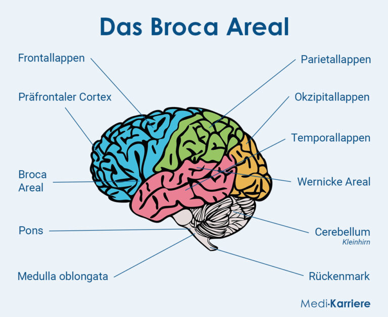 Broca Areal | Medi-Karriere