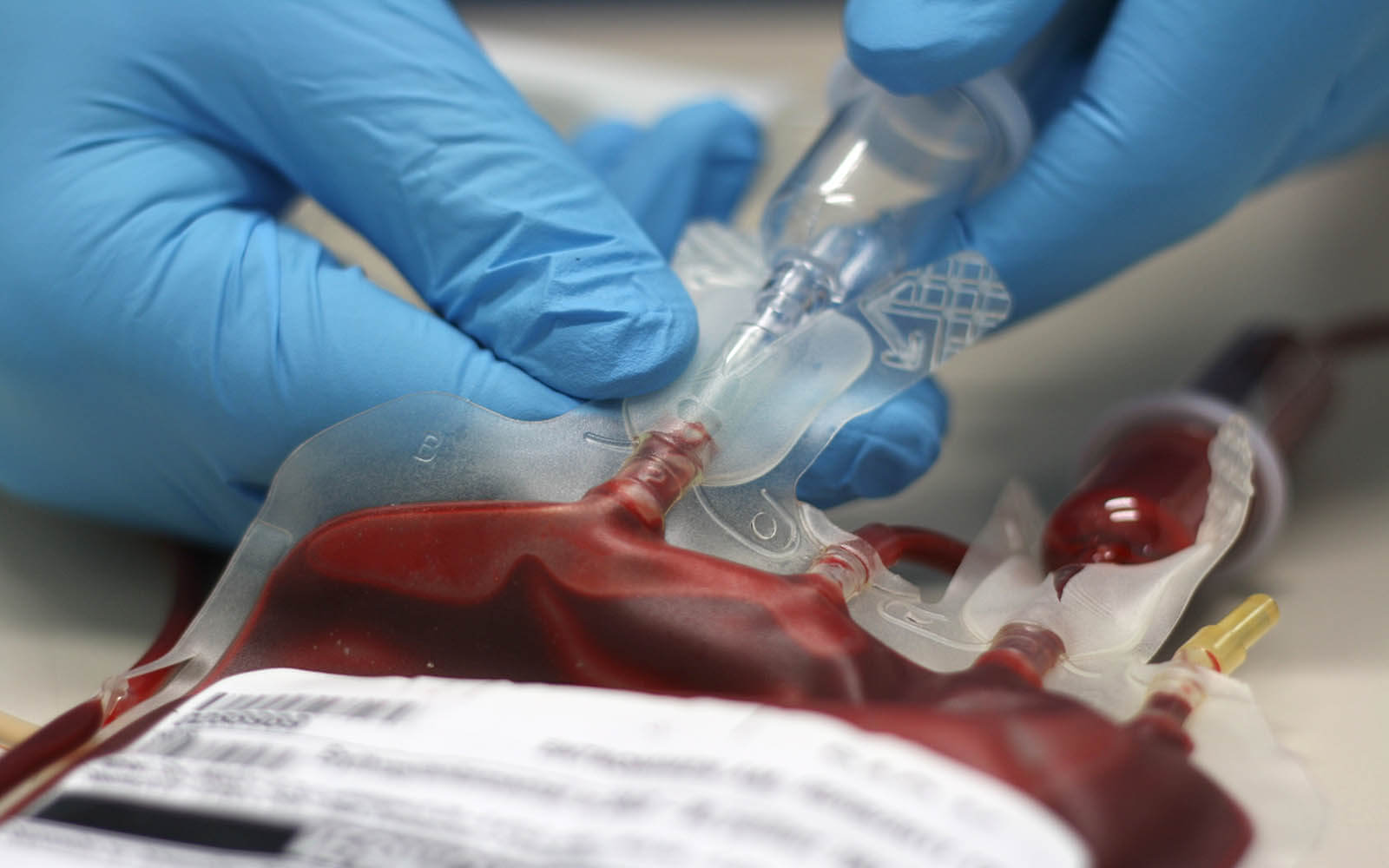 Transfusion: Übertragung von Blut