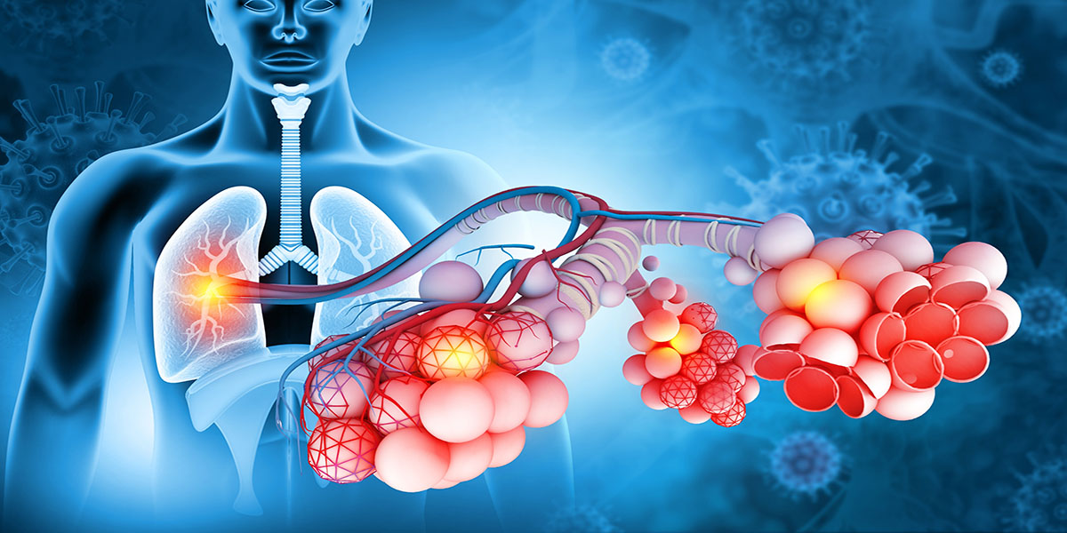 Alveoli,In,Lungs.,Tiny,Air,Spaces,In,The,Lungs,Through