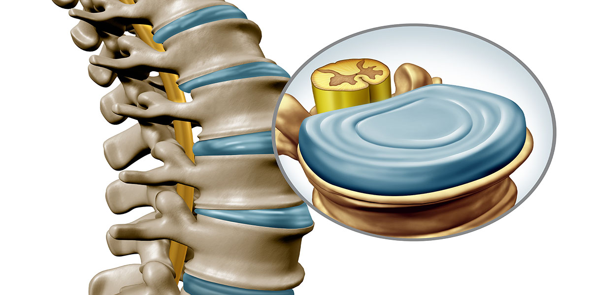 Lumbar,Spine,Disk,Anatomy,Segment,Medical,Concept,As,A,Close