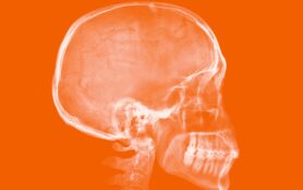 Human,Skull.,X Ray,Image,Isolated,On,Orange,Background