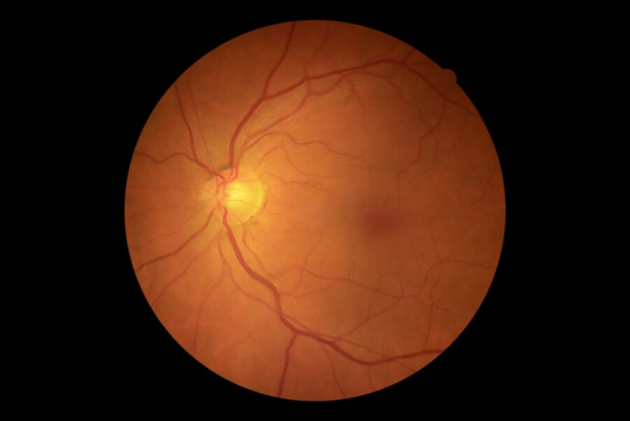 Retina,Of,The,Human,Eye