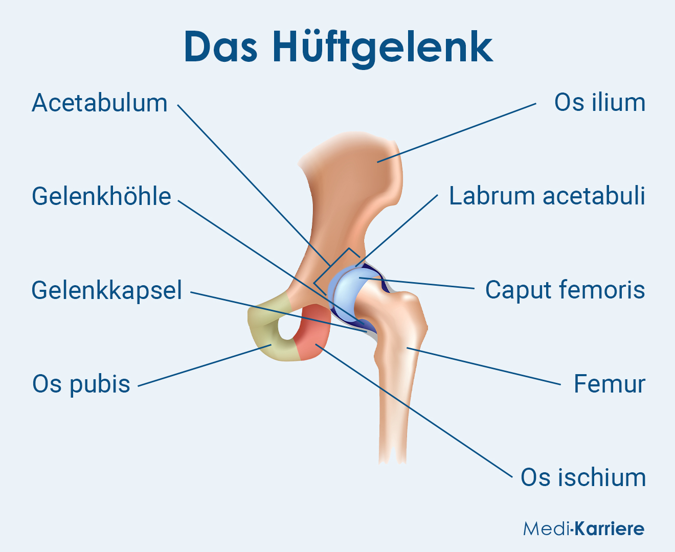 Hüftgelenk Grafik