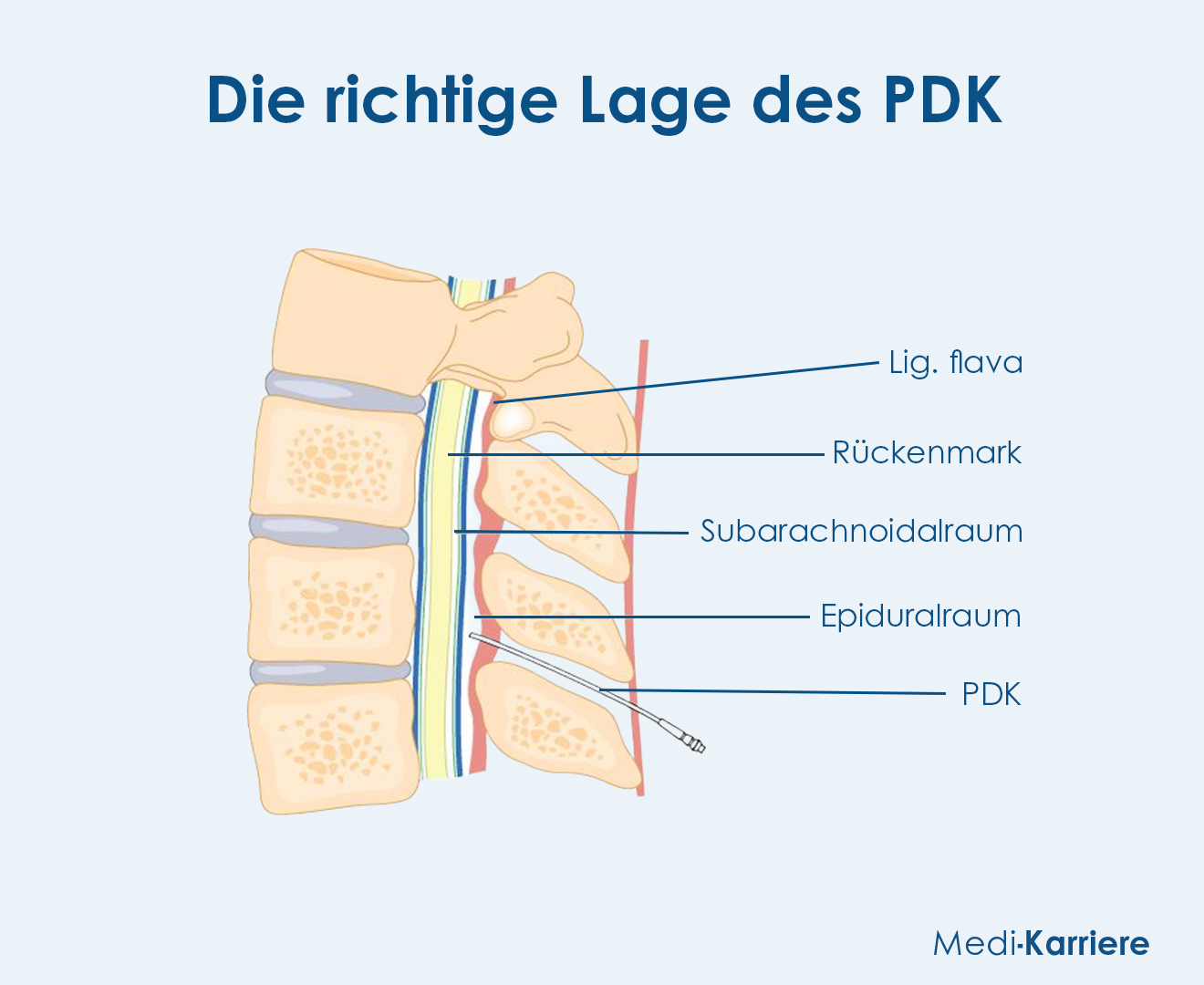 PDK.Grafik