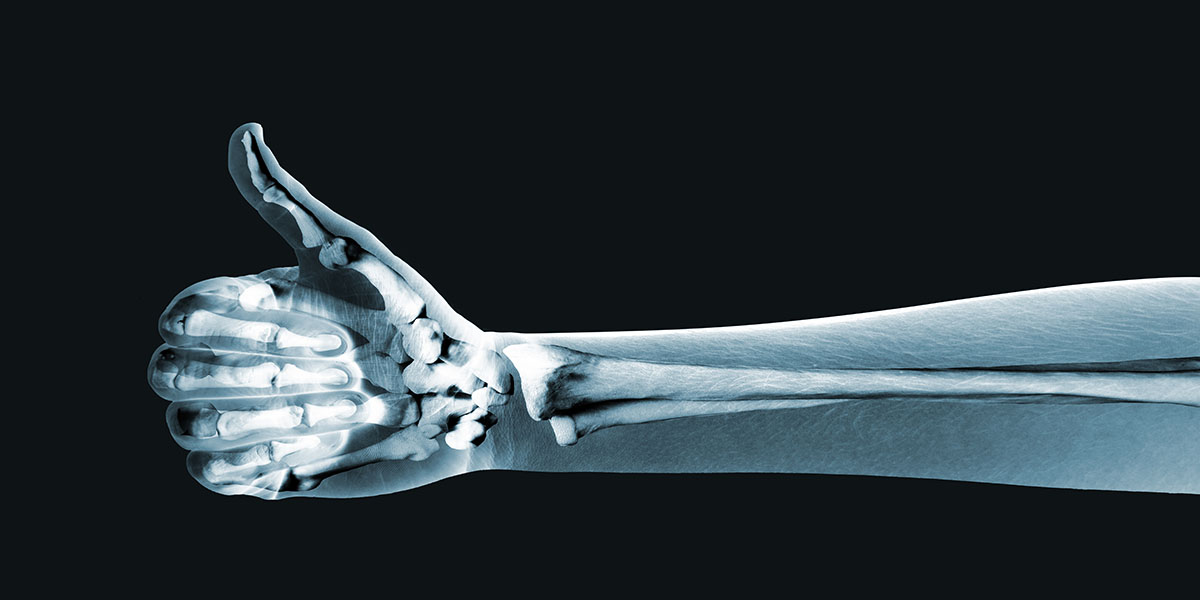 X Ray,Hand,On,Black,Background