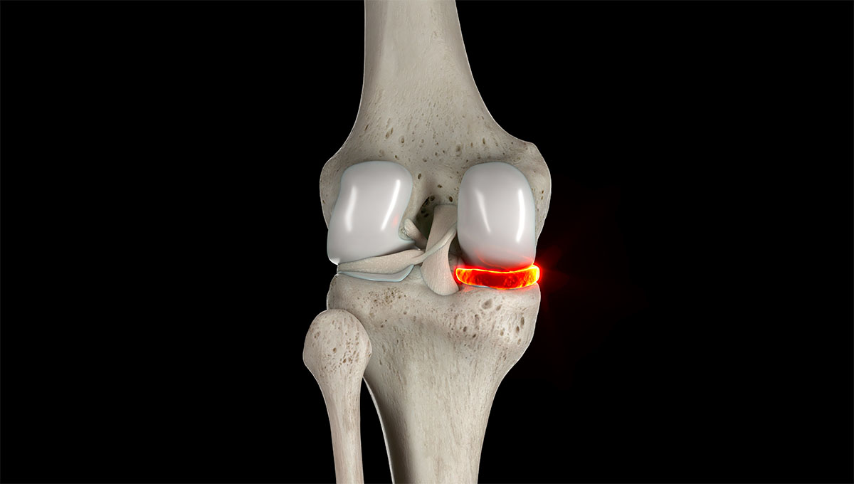 3d,Rendered,Medical,Illustration,Of,Human,Anatomy, ,Medial,Meniscus.