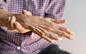 Ulnar,Claw,Hand,Of,Asian,Elder,Woman.,It,Develops,Due