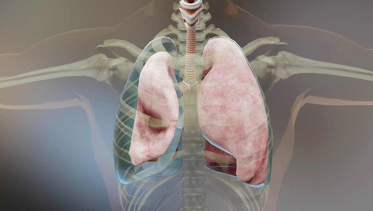 3d,Illustration,Of,Pneumothorax,,Normal,Lung,Versus,Collapsed,,Symptoms,Of