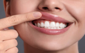 Young,Woman,Showing,Healthy,Gums,On,Grey,Background,,Closeup