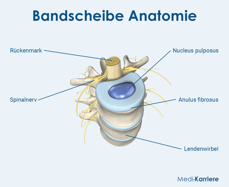 Grafik Bandscheibe