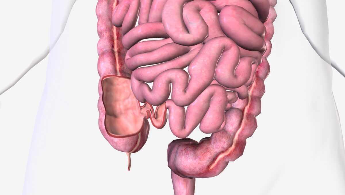 The,Ileocecal,Valve,Is,A,Papillose,Structure,With,A,Physiological