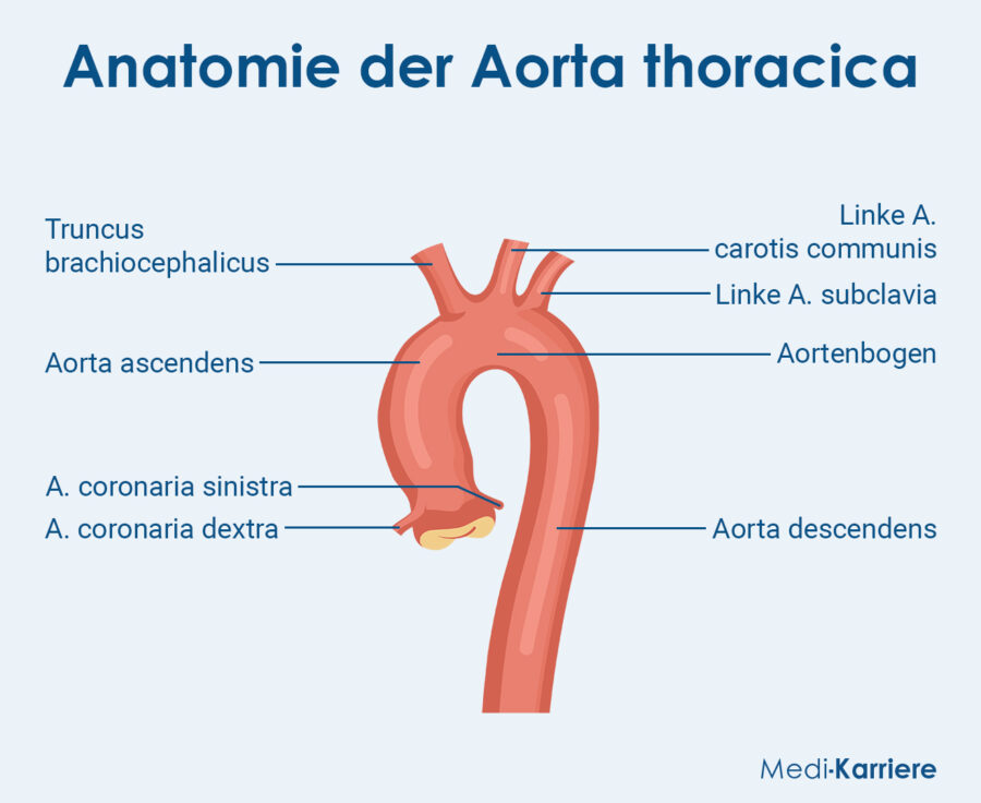 Aorta Ascendens Grafik