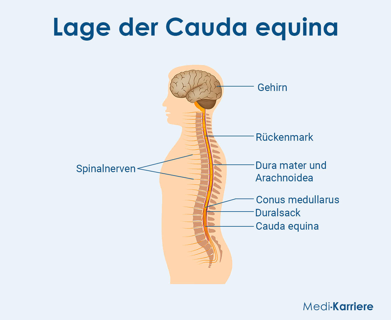 Cauda Equina Grafik