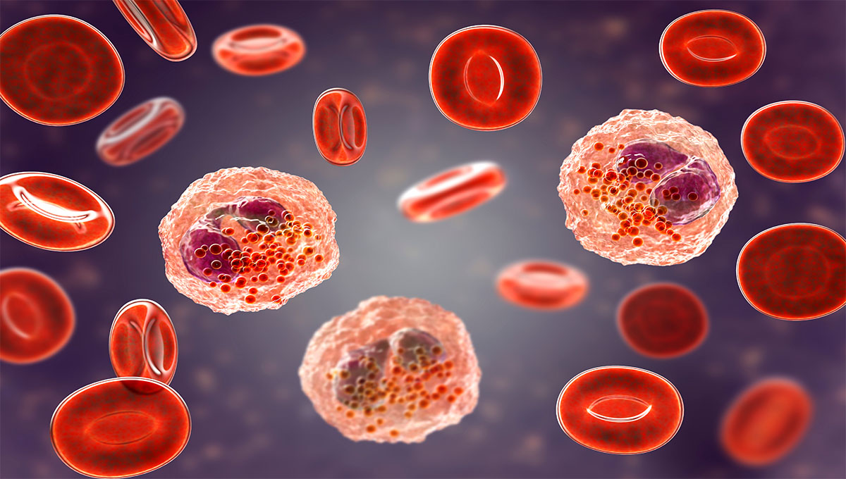 Eosinophilia,,Blood,Smear,Showing,Multiple,Eosinophils,Surround,By,Red,Blood