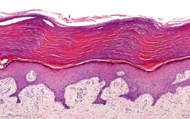 Keratinized,Stratified,Squamous,Epithelium,Of,The,Human,Glabrous,Skin,Showing