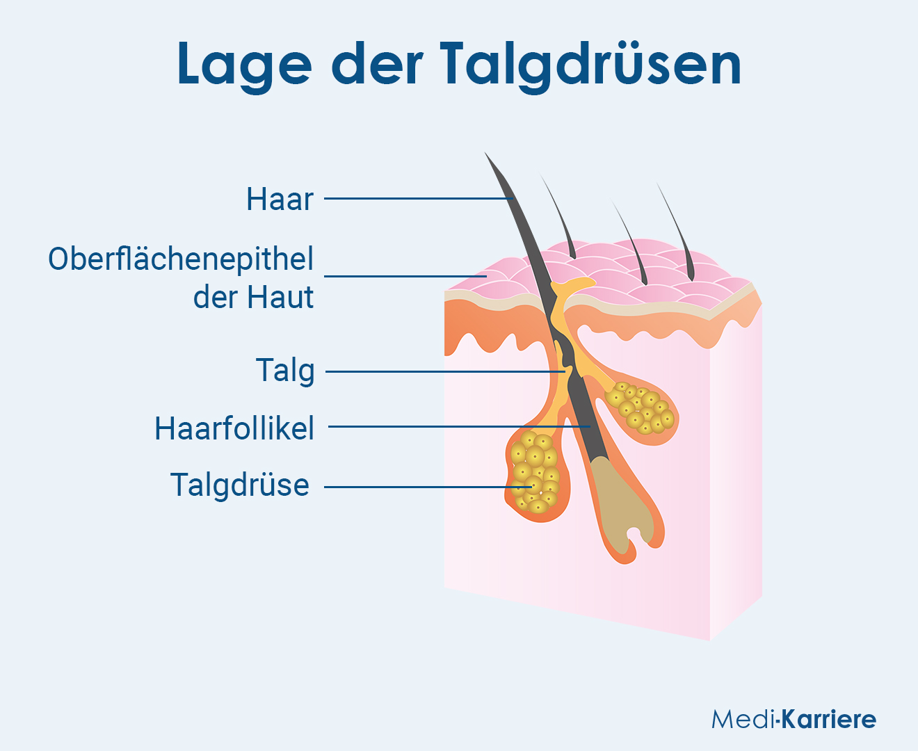 TalgdrÃ¼sen Grafik