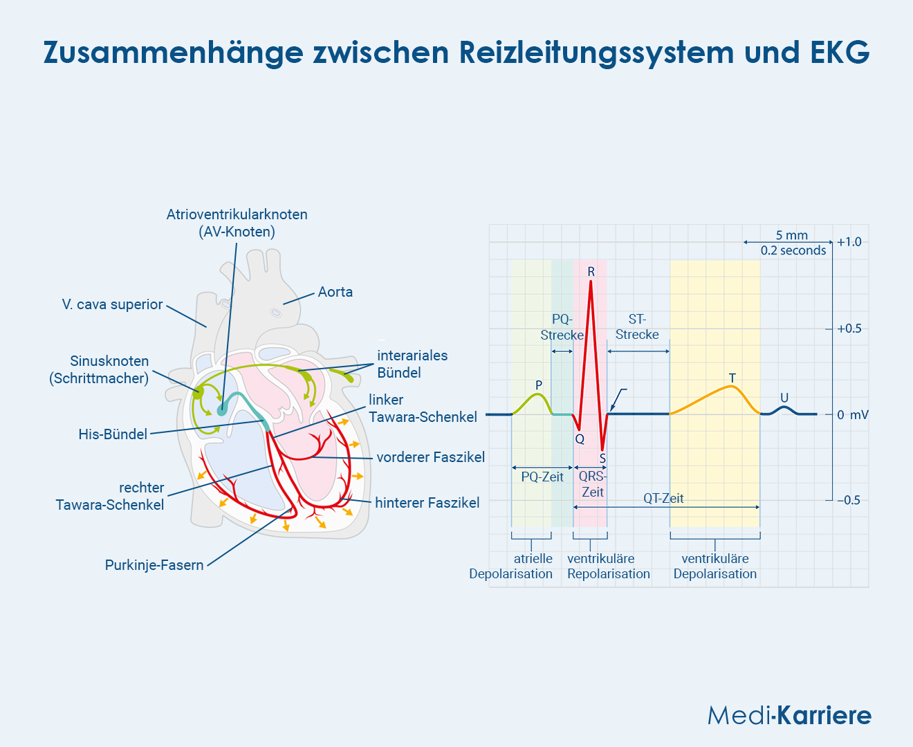 AV Knoten Grafik