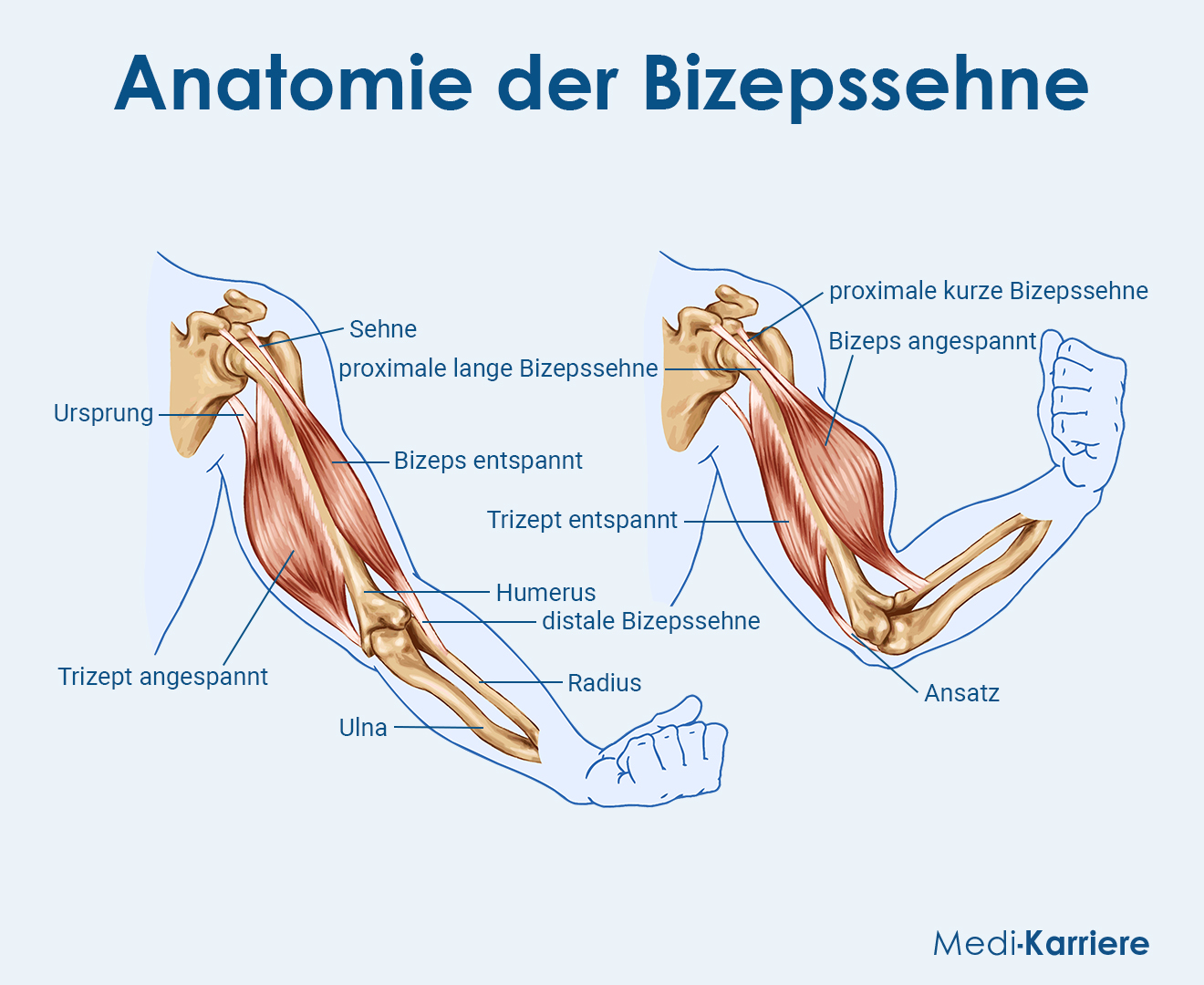 Bizepssehne Grafik