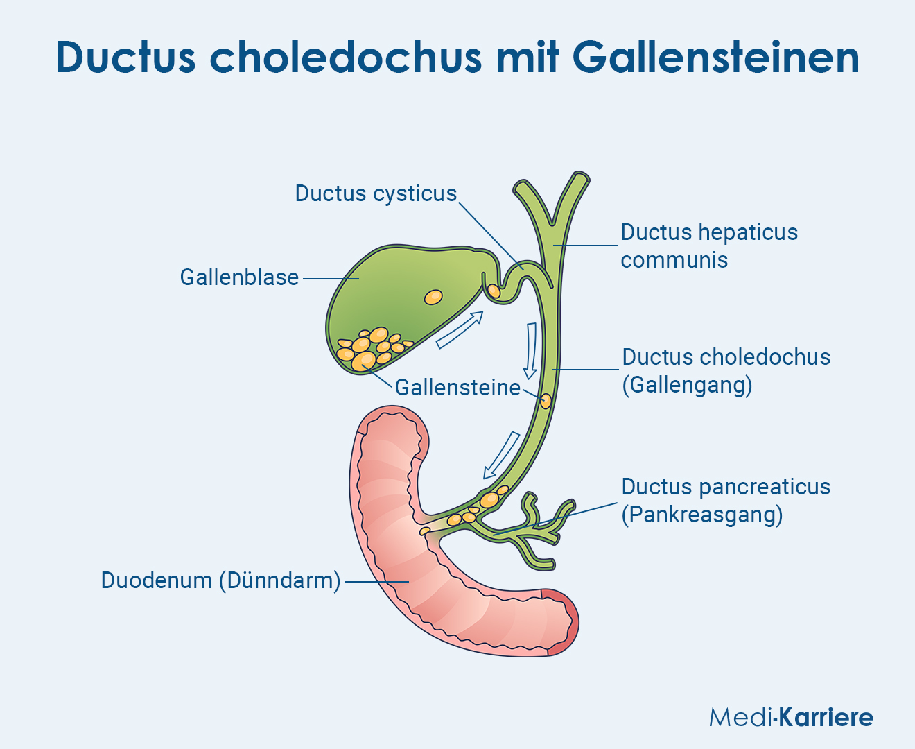 Ductus Choledochus Grafik