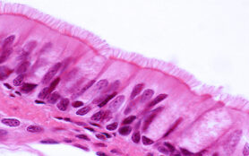 Ciliated,Pseudostratified,Columnar,Epithelium,Of,The,Trachea,(respiratory,Epithelium).,Light