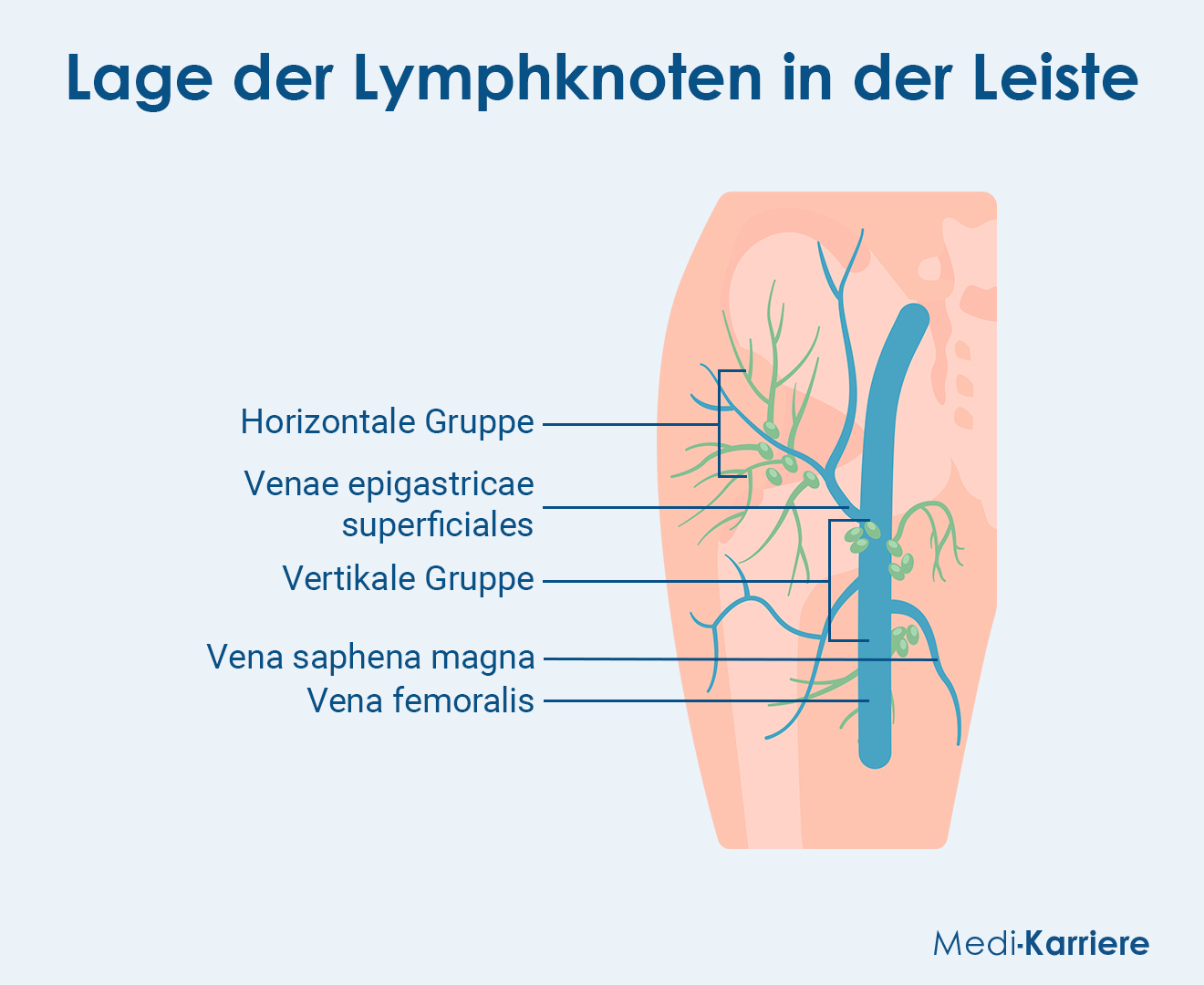 Lymphknoten (Leiste) Grafik