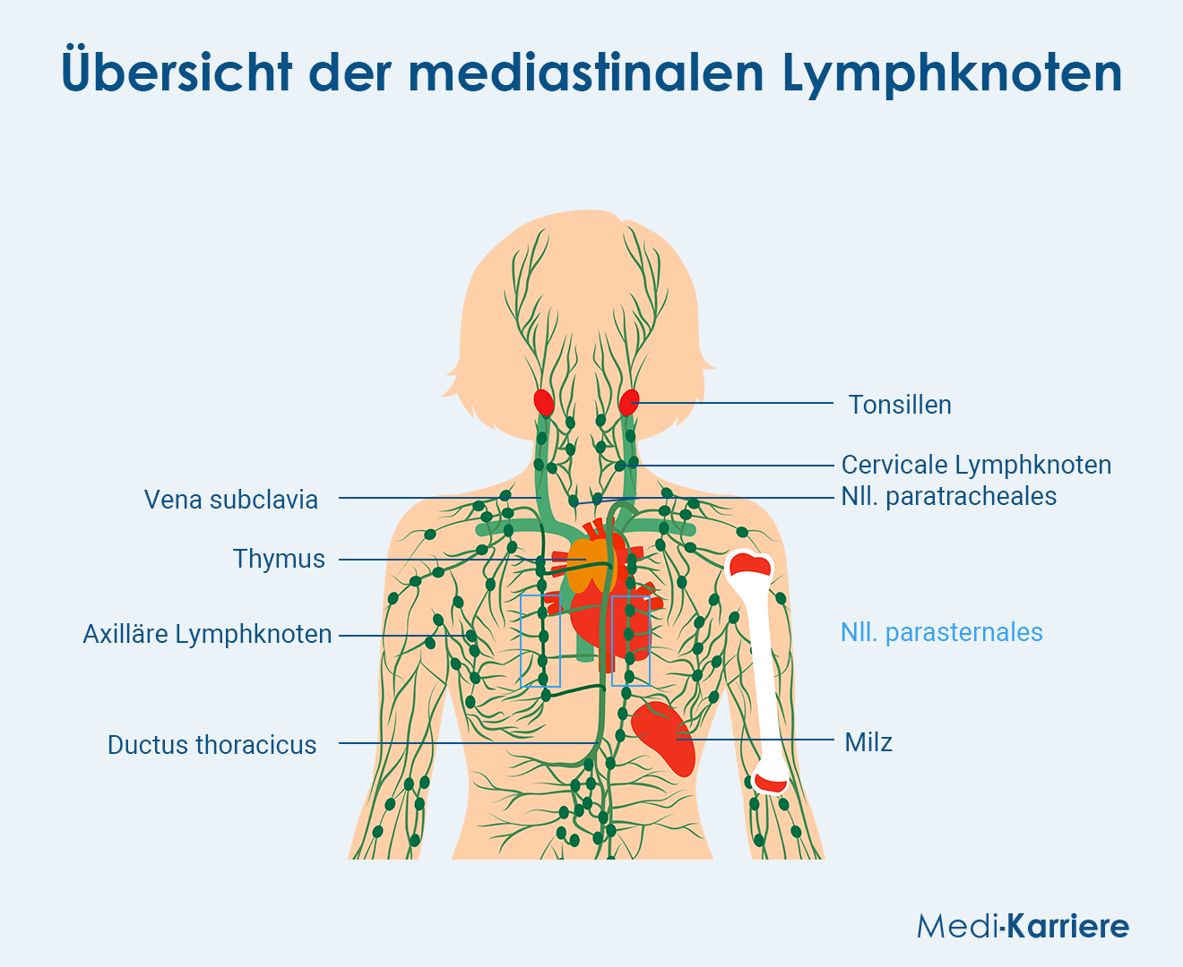 Mediastinale Lymphknoten Grafik