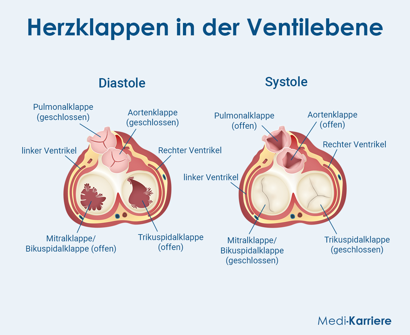 Mitralklappe Grafik