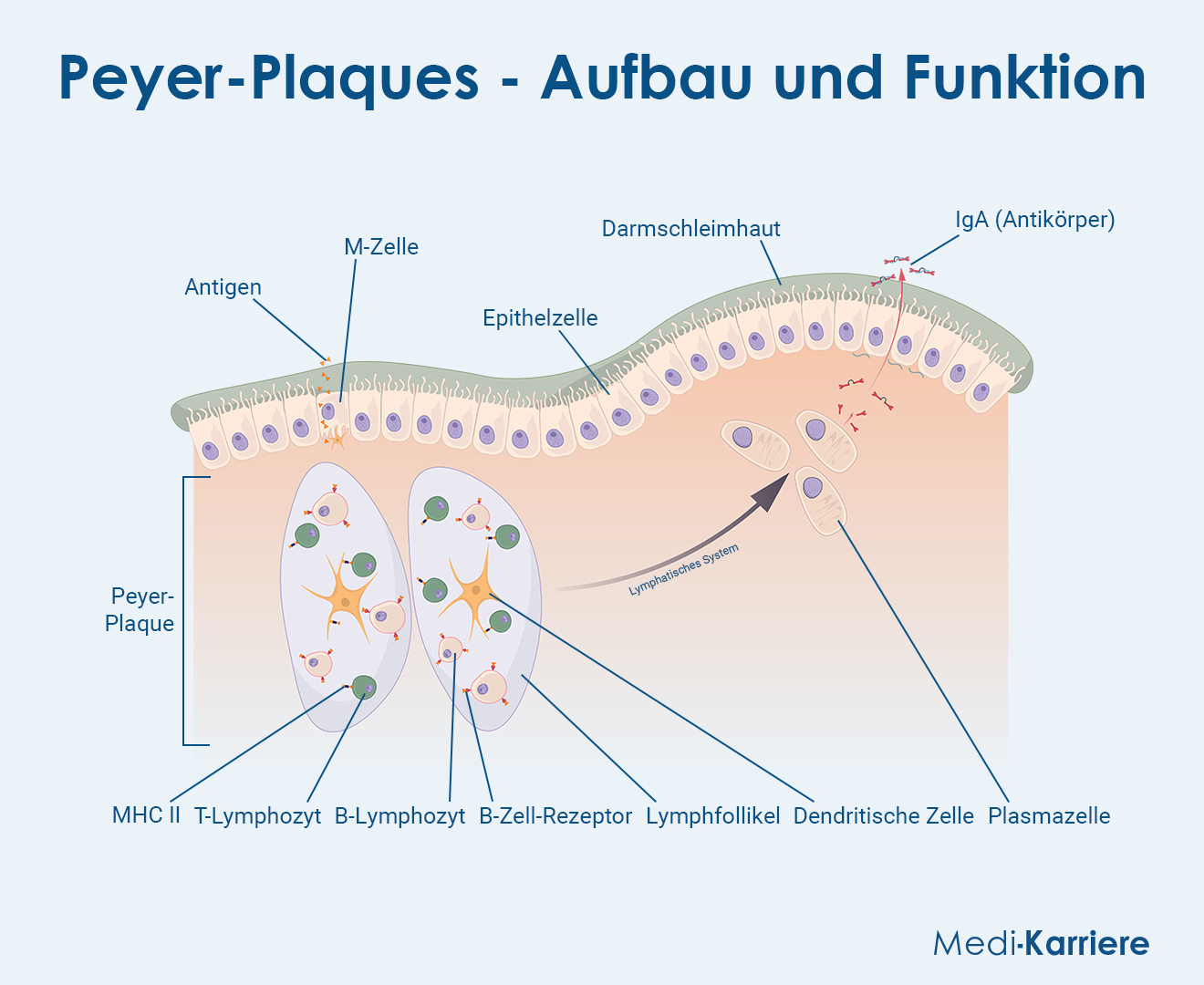 Peyer Plaques Grafik