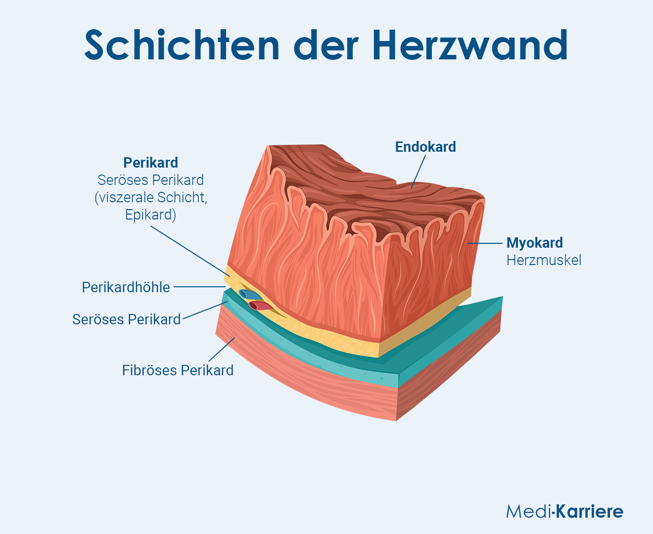 Endokard Grafik