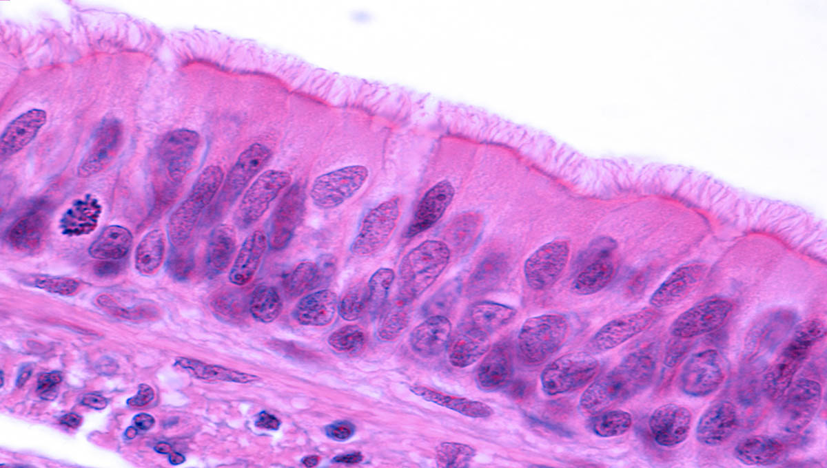 Ciliated,Pseudostratified,Columnar,Epithelium,Of,The,Trachea,(respiratory,Epithelium).,Light