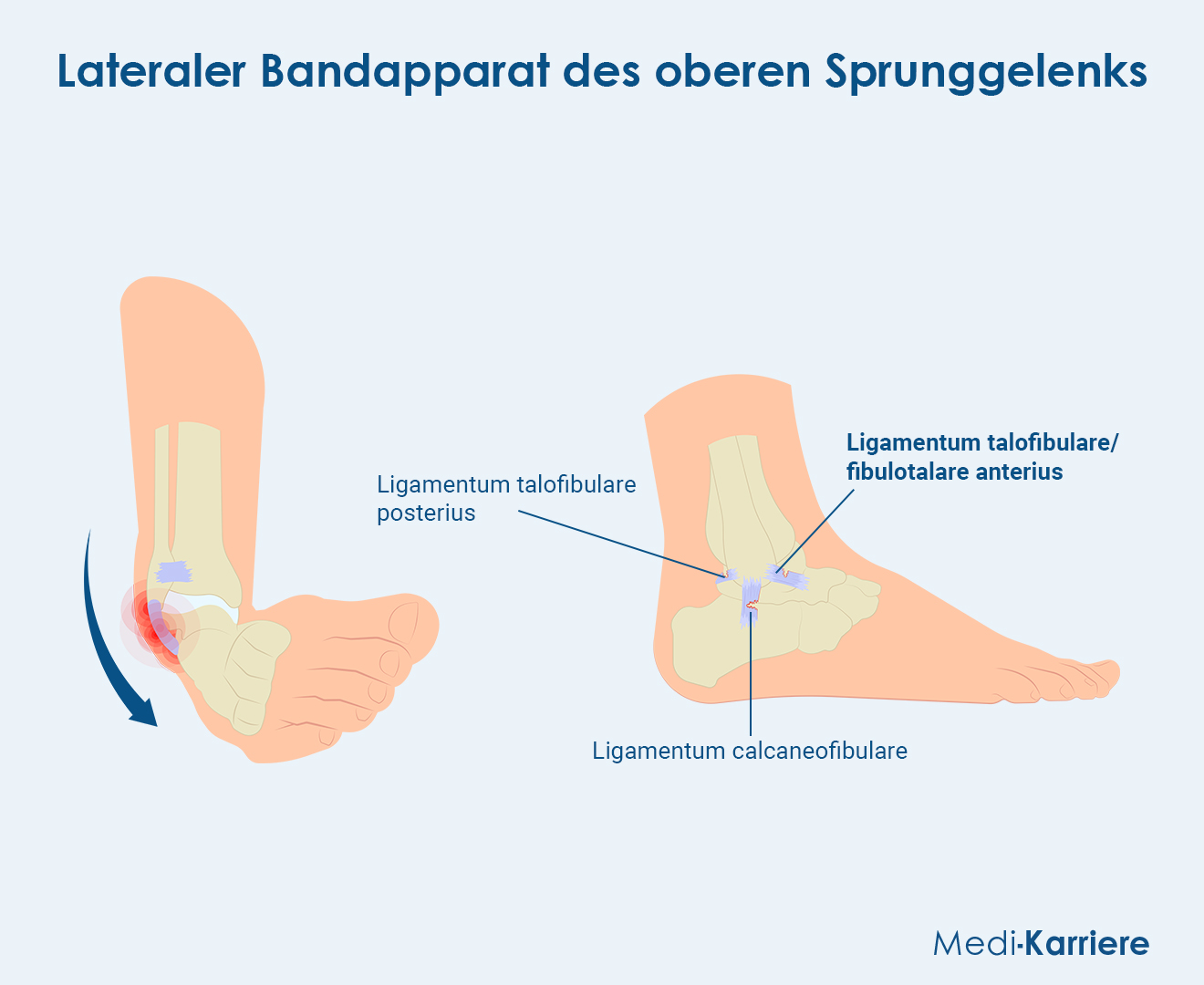 Ligamentum Fibulotalare Anterius Grafik