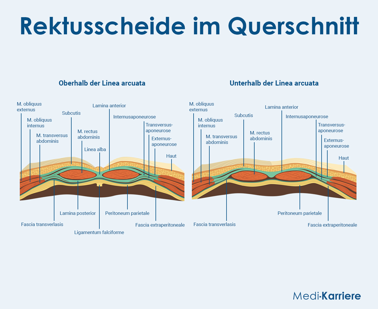 Rektusscheide Grafik