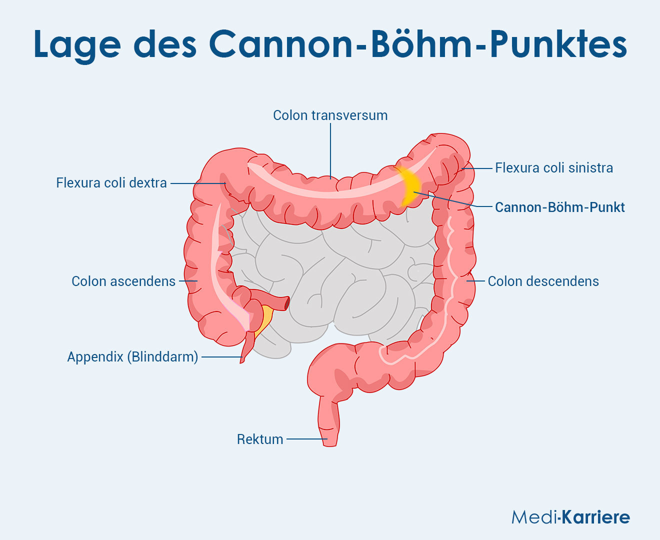 Cannon Böhm Punkt Grafik