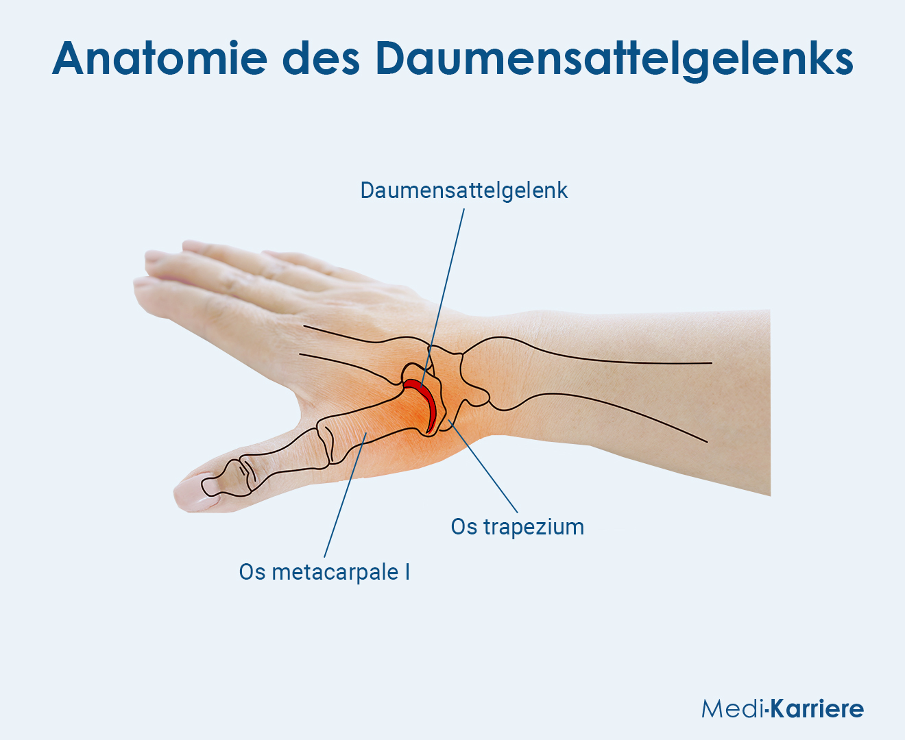 Daumensattelgelenk Grafik