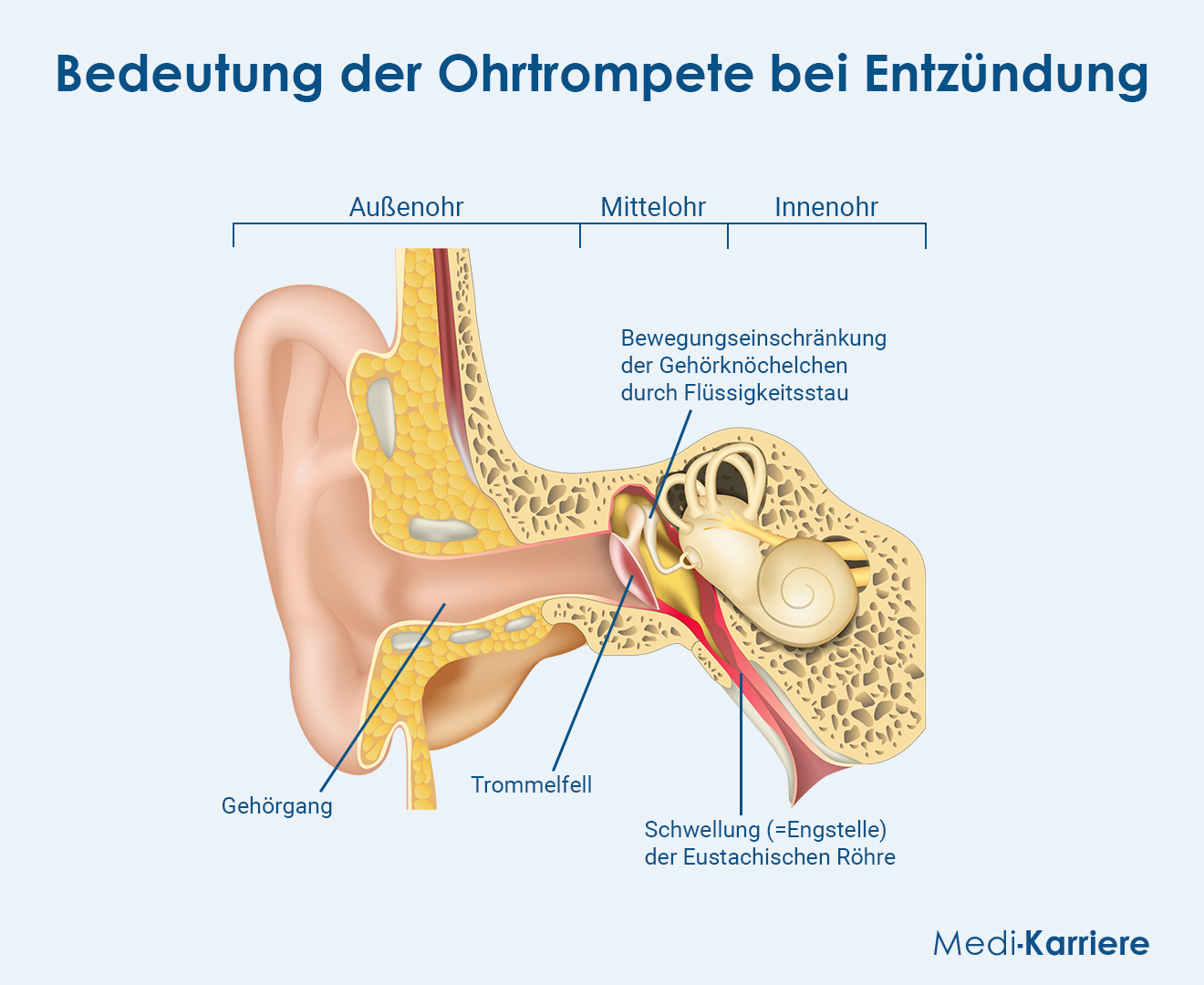 Eustachische RÃ¶hre Grafik