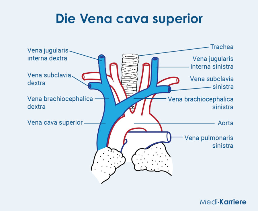 Grafik Vena Cava Superior