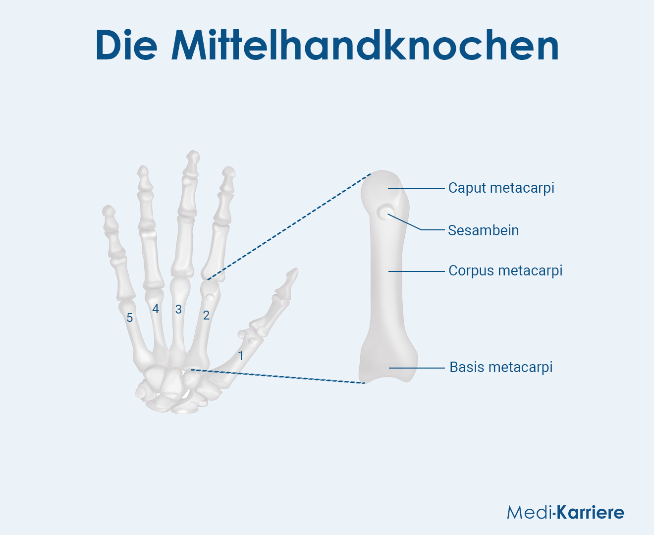 Mittelhandknochen Grafik