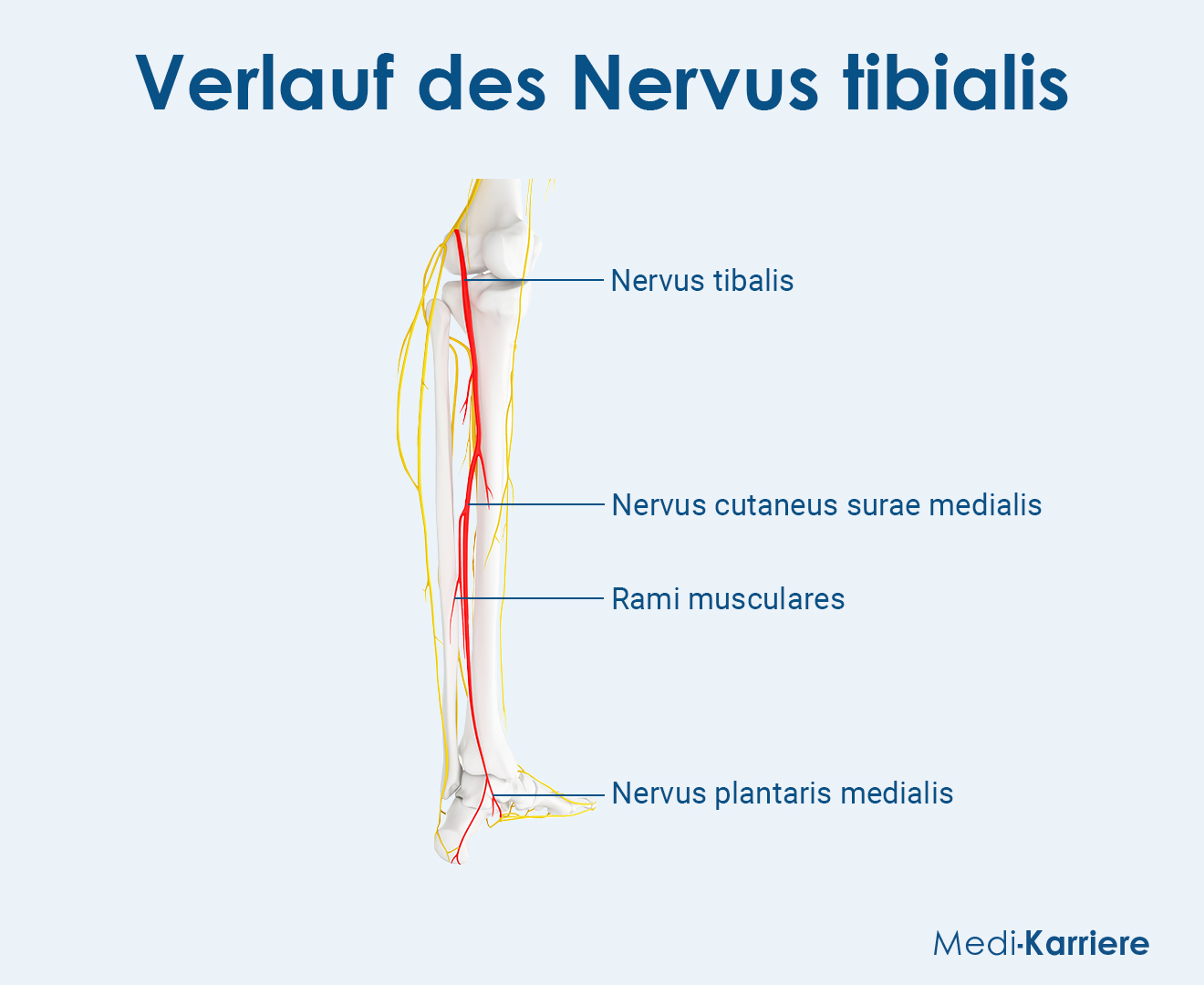 Nervus Tibialis Grafik