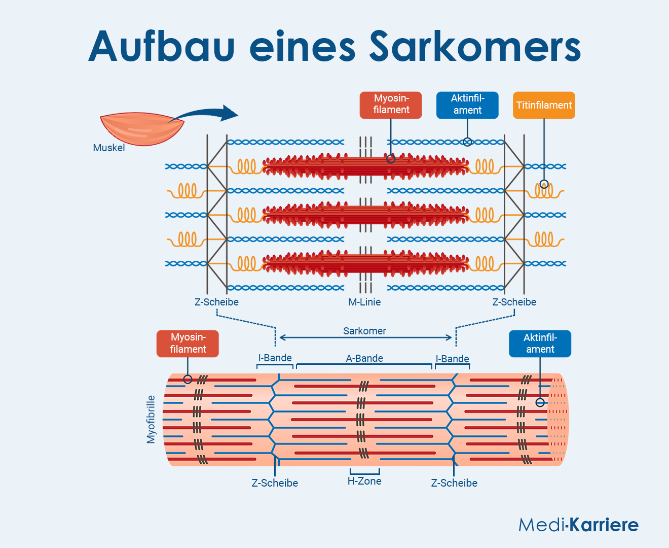 Sarkomer Grafik