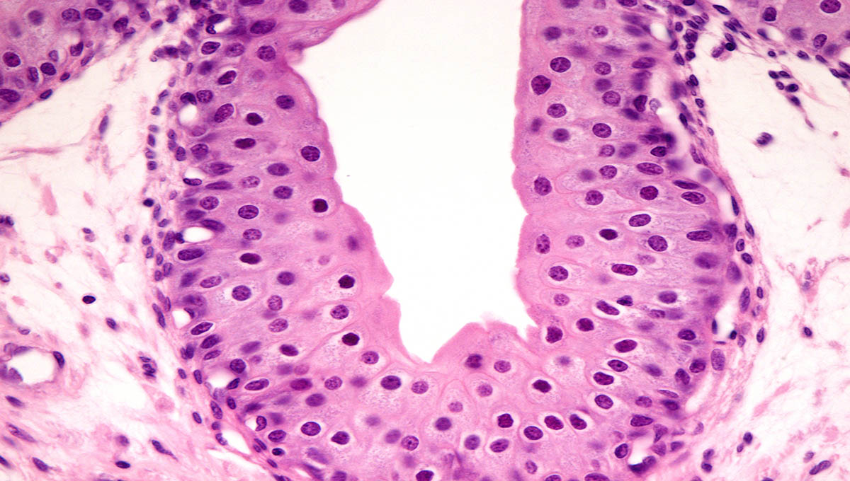 Transitional,Epithelium,(urothelium),Of,The,Ureter.,The,Epithelium,Shows,A