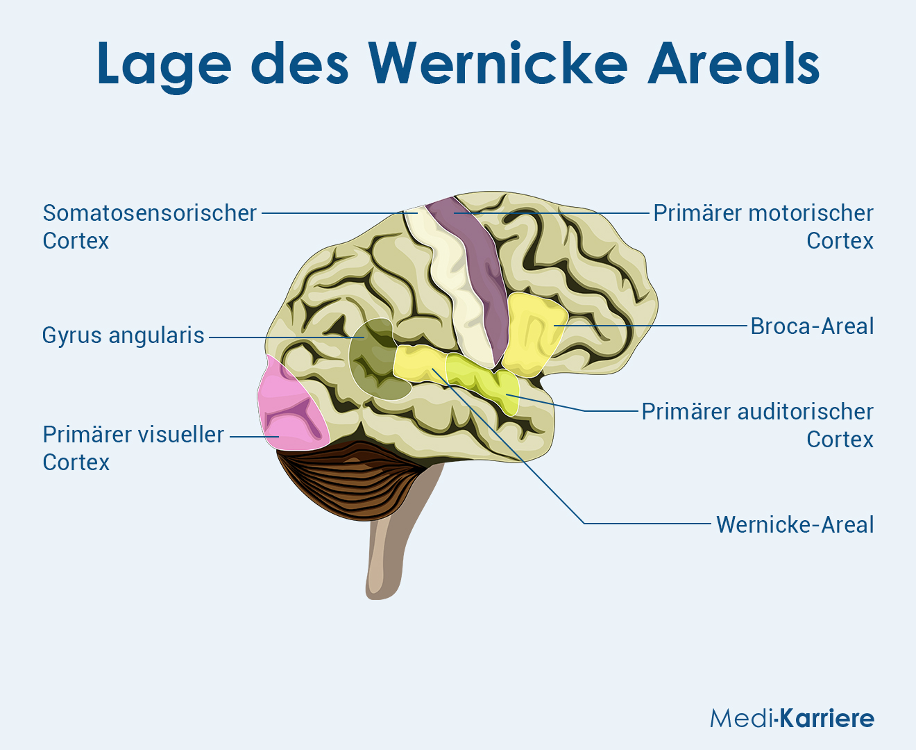 Wernicke Areal Grafik