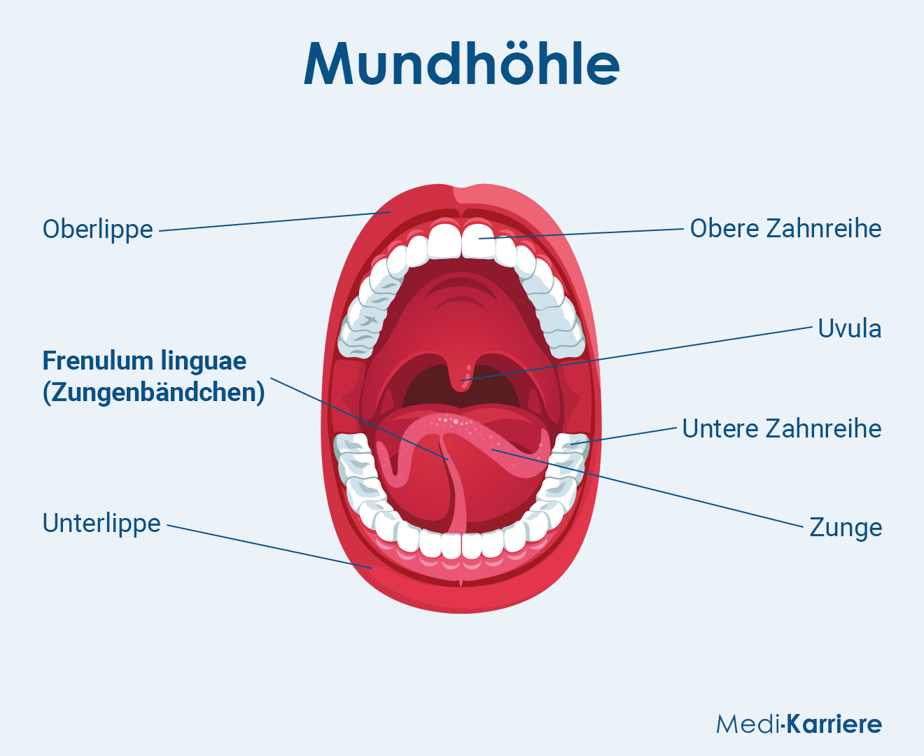 Zungenbändchen Grafik