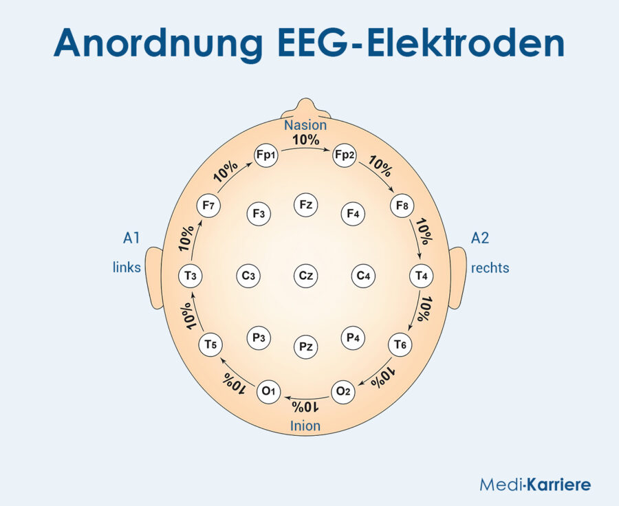 Grafik EEG 1