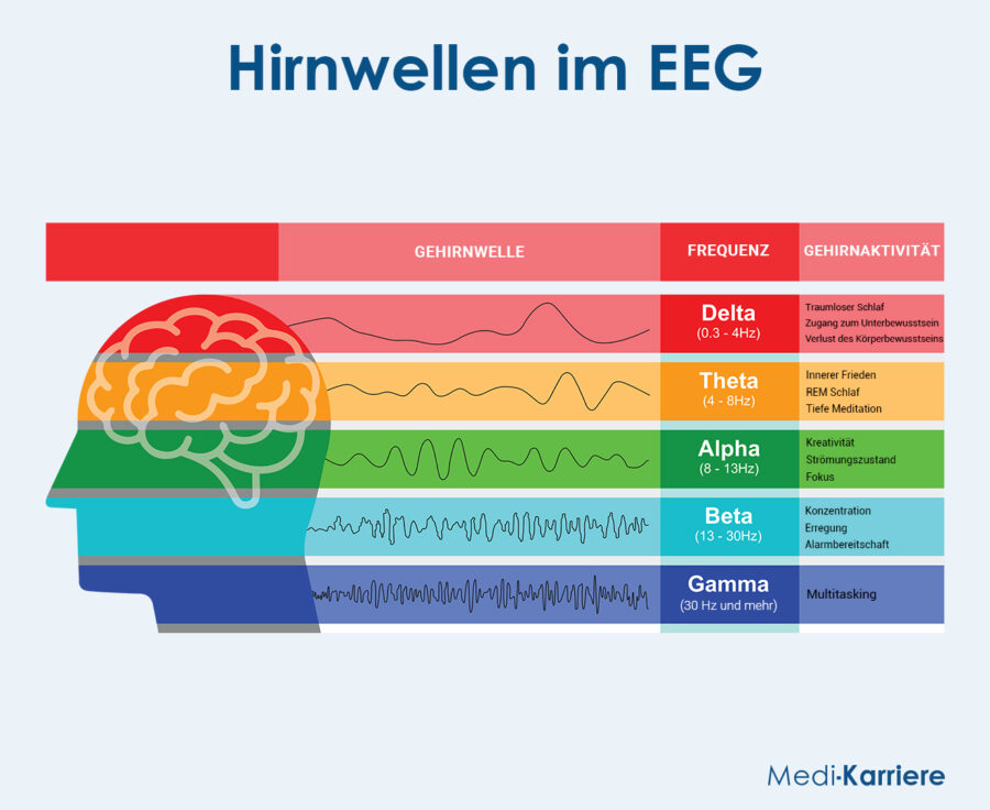 Grafik EEG 2