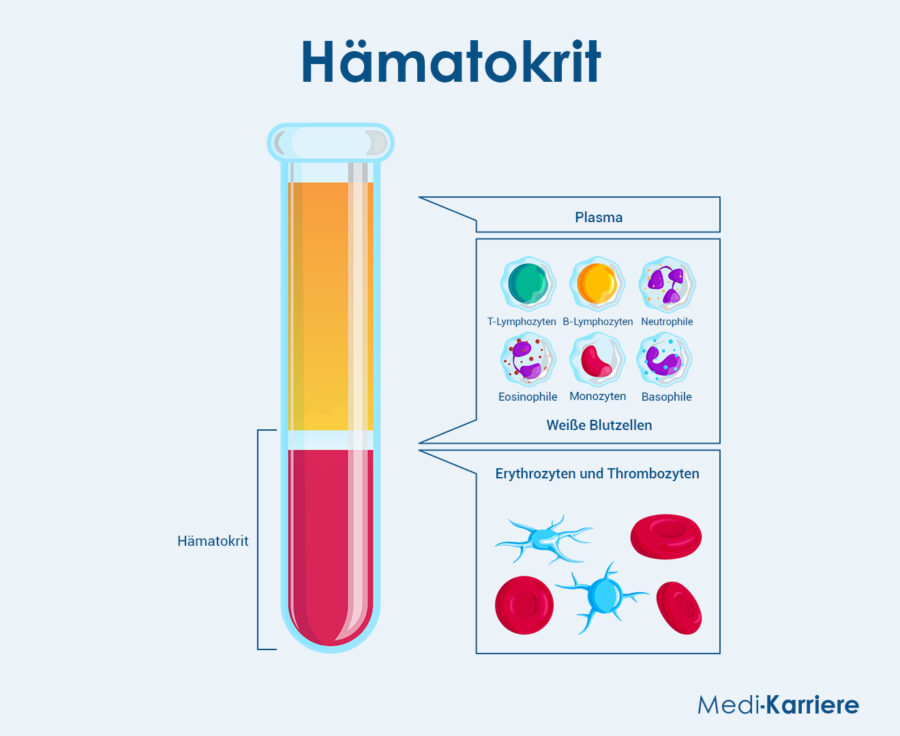 Hämatokrit Grafik