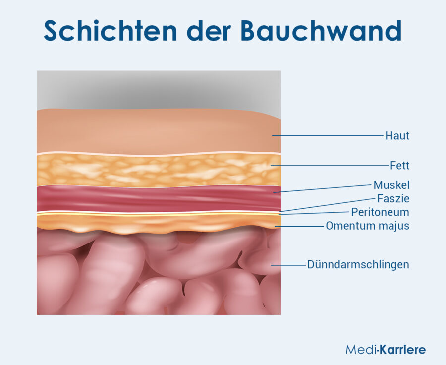 Peritoneum Grafik