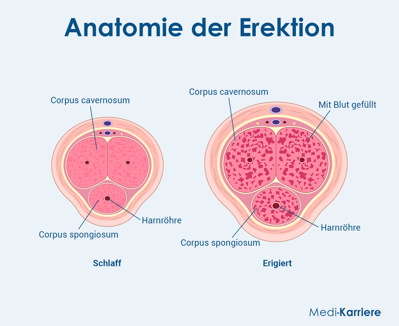 Erektion Grafik