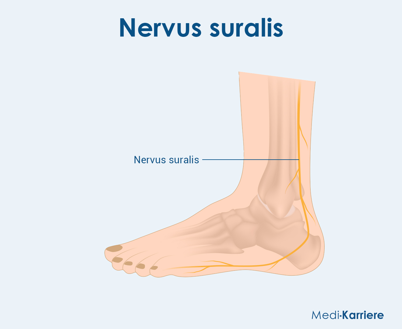 Nervus Suralis Grafik