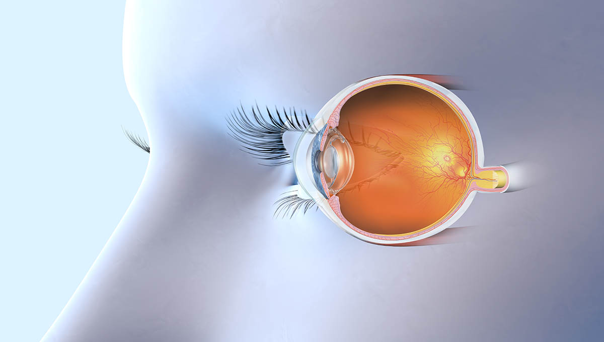 Medically,3d,Illustration,Showing,Human,Eye,With,Artificial,Lens,,Pupil,