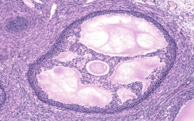 Large,Ovarian,Antral,Follicle,Or,Tertiary,Follicle.,In,The,Last